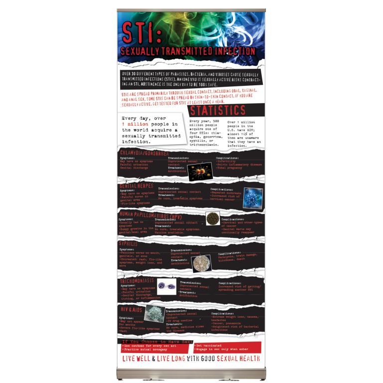 STI Retractable Display